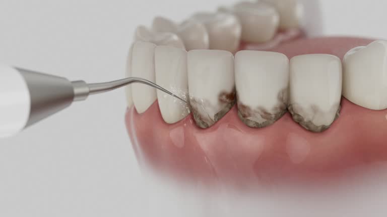 Reliable Dental Implants contractor in Stromsburg, NE by Smile Center Dentistry